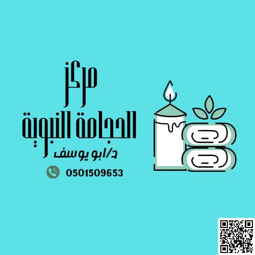 حجامة نبوية